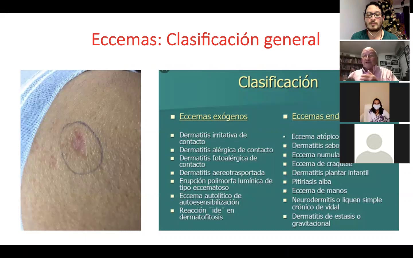ECCEMA NUMULAR