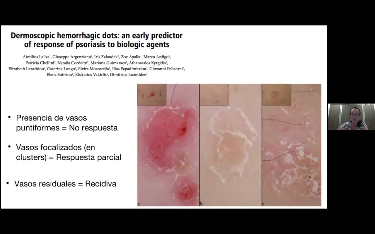 Dermatoscópico de pápulas eritemadescamativas